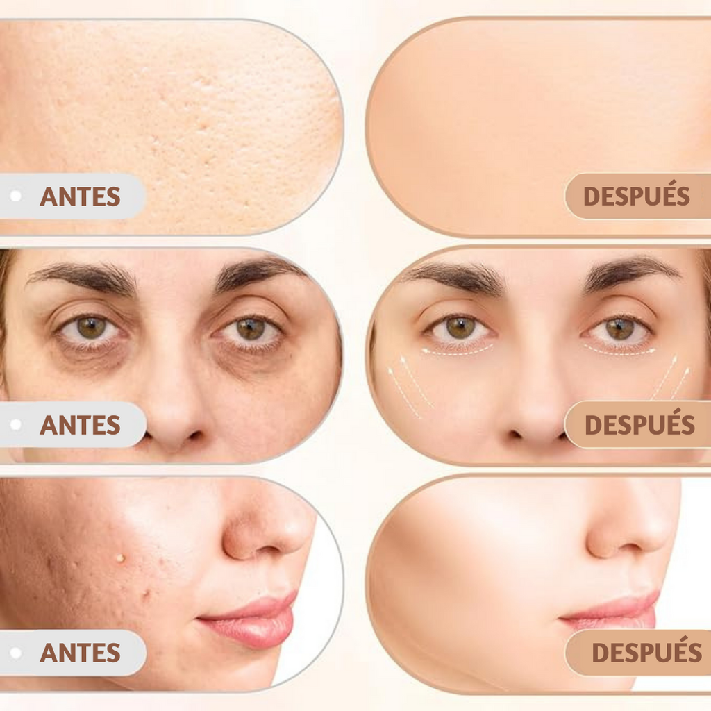 Recuperador facial 6 en 1